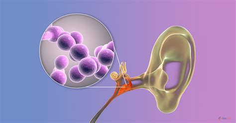 Otomycosis Symptoms Treatment Causes Types And Diagnosis