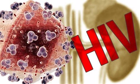 As the virus continues to multiply and destroy your immune cells — the cells in your body that help fight off germs — you may develop mild infections or chronic signs and symptoms such as: อาการของคนติดเชื้อ HIV หรือ เอดส์ เมื่อได้รับเชื้อไวรัสนั้น