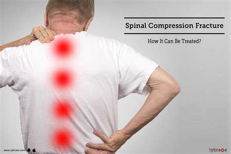 Spinal Compression Fracture How It Can Be Treated By American
