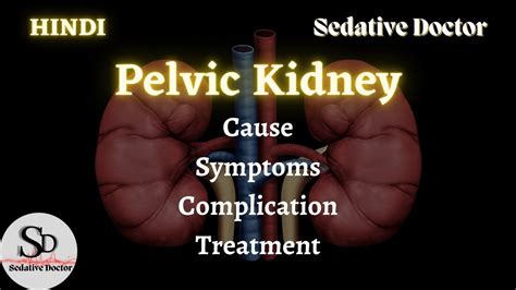 Pelvic Kidney Nephroptosis Floating Kidney Sedative Doctor