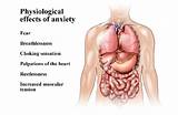 Pictures of Severe Anxiety Disorder Treatment