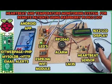 Iot Based Heartbeat And Temperature Monitoring System For Remote