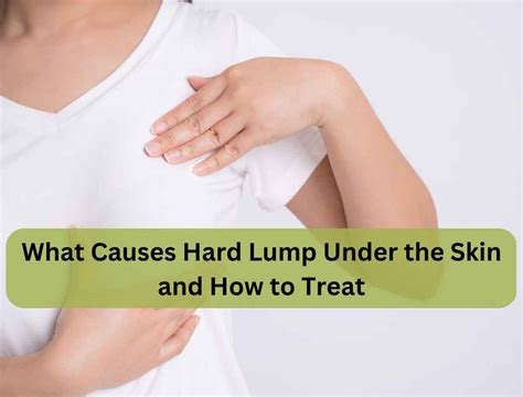 What Causes Hard Lump Under The Skin And How To Treat