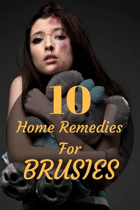 How To Get Rid Of Bruises Fast Top 10 Home Remedies To Heal A Bruise