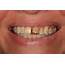 Dental Forum Online Education  Case Details Periodontally