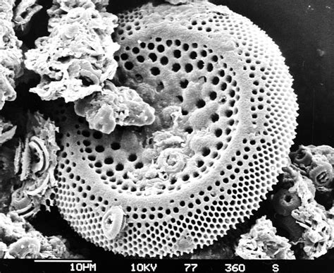 Diatom Diatom Microscopic Diatomaceous Earth