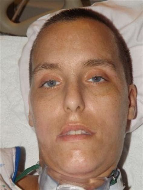 unidentified woman emerges from 3 week coma archives
