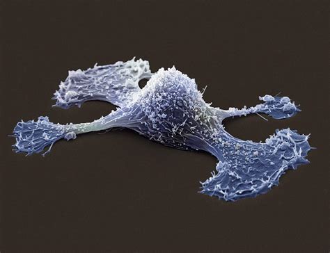 Metastasis Of A Cancerous Cell Sem Photograph By Steve Gschmeissner