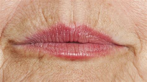 4 Ways To Promote Wrinkles And How To Reduce Them Naturally Upper Lip