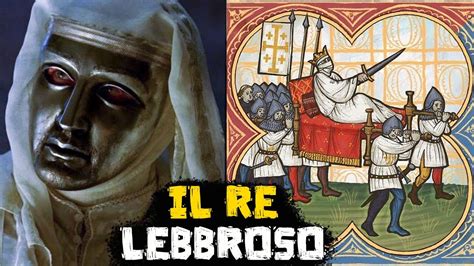 Il Re Lebbroso Baldovino Iv Di Gerusalemme Grandi Personalit Della