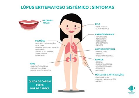 Lupus Eritematoso Sistemico Come Curarlo Con Metodi N