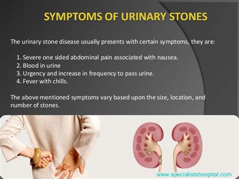 Urinary Stones Treatment Your Ultimate Guide