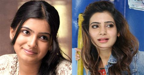 Tollywood Stars Who Have Transformed Majorly Cosmetic Surgeries