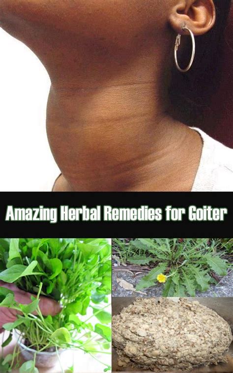 Pin On A Z About Herbal Medicine And Home Remedies
