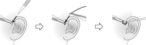 Figure 2 From A Simple And Reproducible Surgical Technique For The