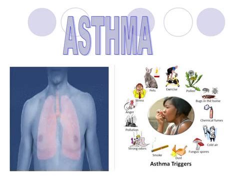 Asthma Ppt Ppt