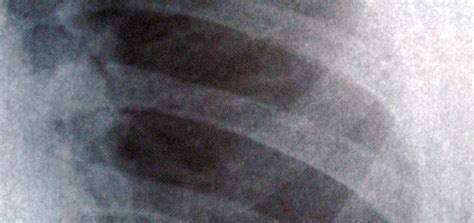 How Long to Become a Respiratory Therapist? | Goodwin College