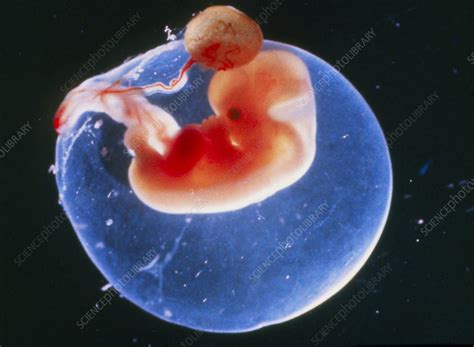 Embryo At Six Weeks Stock Image P6800103 Science Photo Library