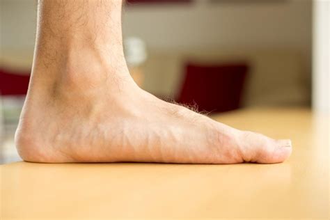 How To Prevent Your Flat Feet From Getting Worse Rocky Mountain Foot