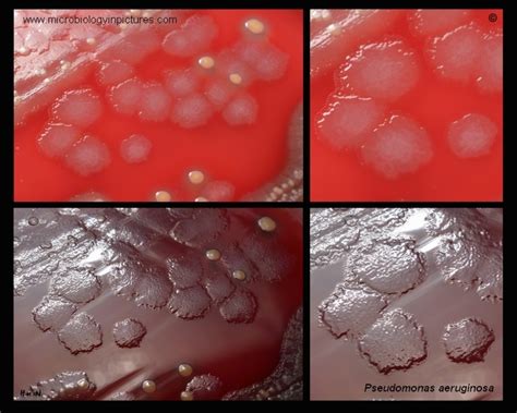 Colony Morphology Of Pseudomonas Aeruginosa Cultivated On Blood Agar