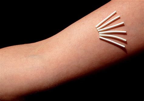 Birth control pills contain hormones like estrogen.and estrogen can make hair grow faster.but that is from the inside. Contraception: The Pros And Cons Of 13 Methods | HuffPost ...