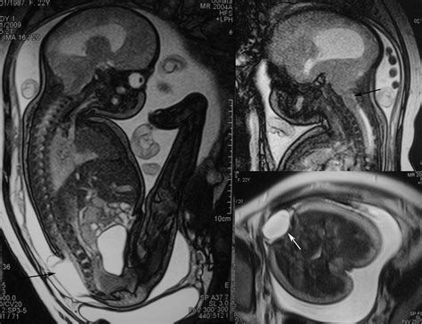 Radiodiagnosis Imaging Is Amazing Interesting Cases Antenatal