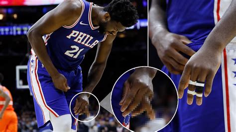 Nba Players With Dislocated Finger Injury Youtube