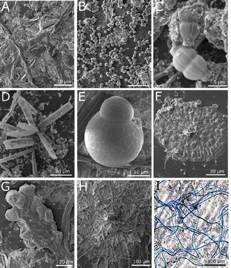 Microscopy Images Of The Microbial Community On Plastic Surfaces From