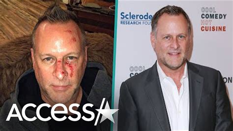 Full House Star Dave Coulier Admits Alcohol Struggles Youtube