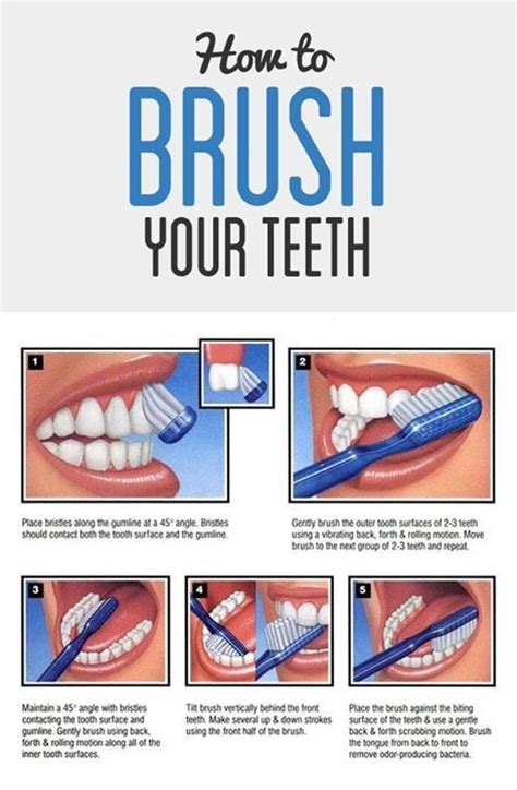 Metal or buccal braces) or lingual braces (aka: High Oaks Dental Practice - Prevention, Education