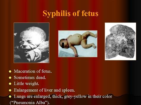 Tertiary And Congenital Syphilis Principles Of Therapy And