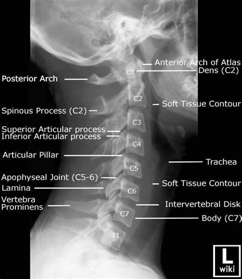 Cervical Spine Radiographic Anatomy Radiology Student Radiology