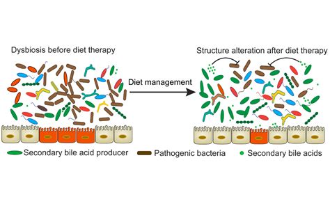 The Diet Microbiome Connection In Inflammatory Bowel Disease