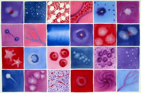Michele Bankss Painting Of Cancer Cells Inspired By Carl Sagan The