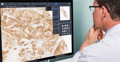 Roche Releases Enterprise Platform For Pathology Images Health Data