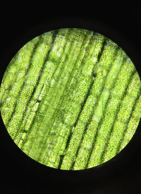Plant Cells Through A Microscope Micropedia