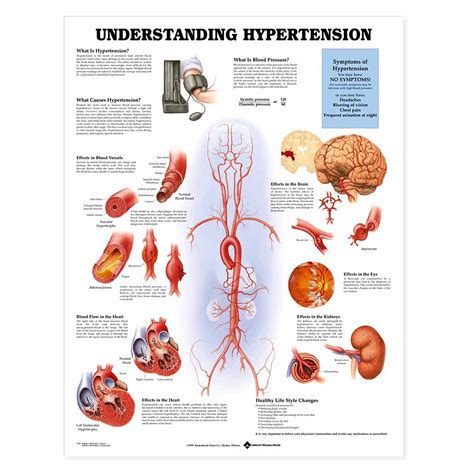 Hypertension Management Chart