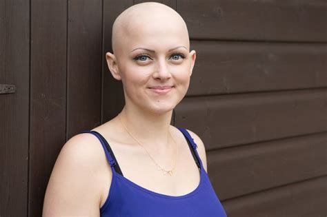 Beautiful Hairstylist With Alopecia Reveals Bald Head For First Time In
