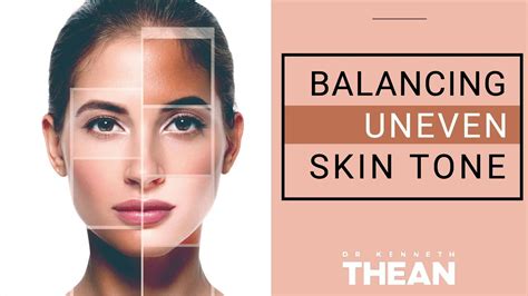 What Causes Uneven Skin Tone And How To Treat It Naturally Youtube