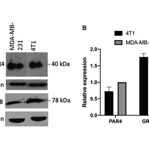 Basal Expression Of Prostate Apoptosis Response Par Protein And