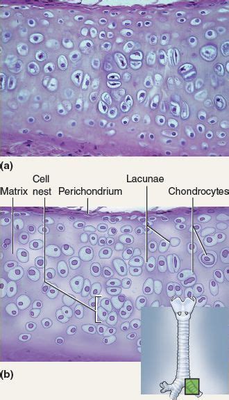 This Tissue Is Hyaline Cartilage Hyaline Cartilage Is Characterized By
