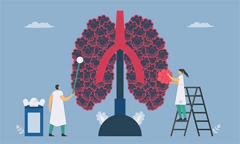 Drug Discovery For Copd Treatments