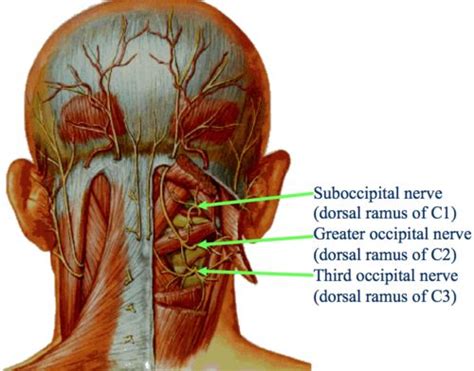 Pin By Los Guaduales On Knowing My Body Occipital Nerve Block
