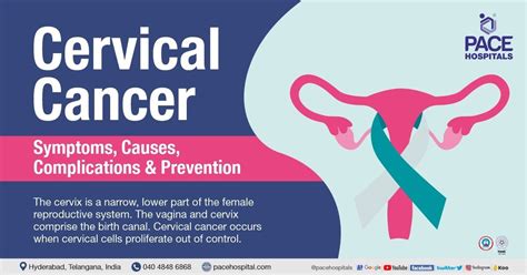 Understanding Cervical Cancer Causes Symptoms And Treatment