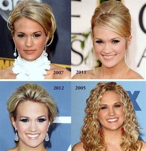 Carrie Underwood Plastic Surgery Before And After Photos Carrie