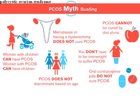 Pcod And Pcos Causes Symptoms Differences And Treatment 43 Off