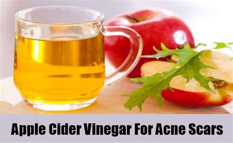 Apple Cider Vinegar For Acne Scars Beauty And Blush