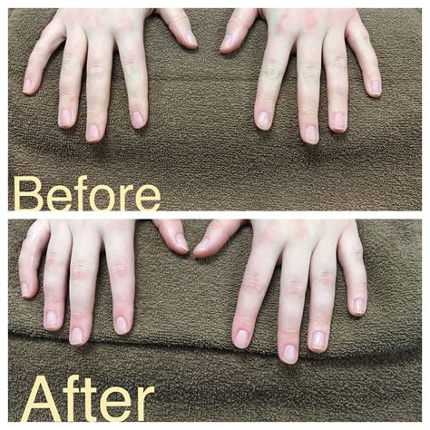Before And After On My Men S Manicure Every Clean And Simple Difference Mensmanicure Clean