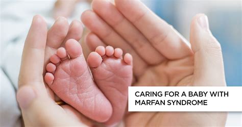 Pediatric Marfan Syndrome Causes Symptoms And Treatment