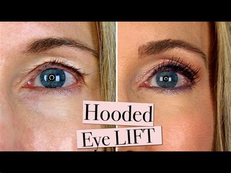 Makeup To Disguise Droopy Eyelids